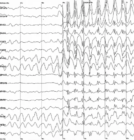 Effect of acute stress on dynamic decision making